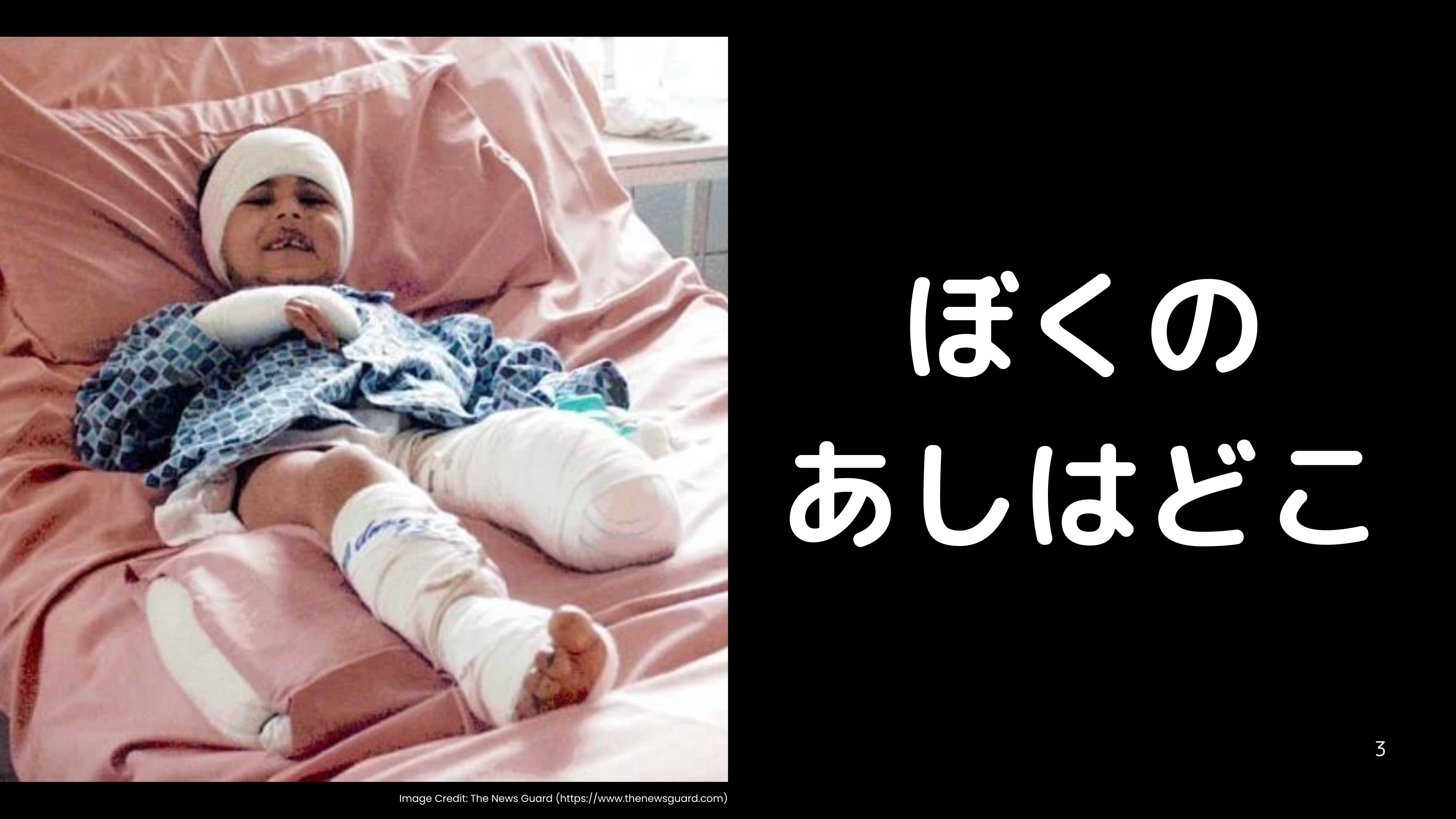 地雷探知の人 僕の足はどこ？」今なお毎年5,000人を苦しめる地雷の被害 九州大